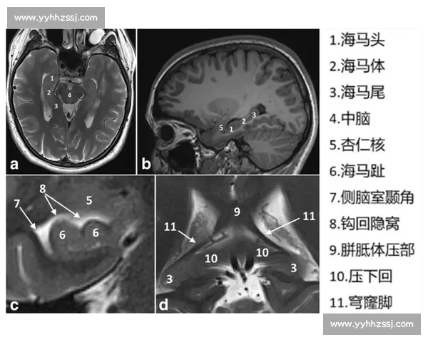 海马体在记忆形成与空间导航中的核心作用及其神经机制研究